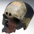 Study Skull from McDowell&rsquo;s College